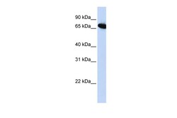 Aviva Systems Biology Corp DLX4 Antibody - middle region (ARP34507_P050)