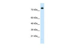 Aviva Systems Biology Corp ZMYM3 Antibody - N-terminal region (ARP34515_T100)