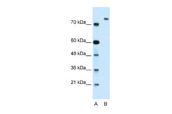 Aviva Systems Biology Corp ZMYM3 Antibody - N-terminal region (ARP34516_T100)