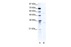 Aviva Systems Biology Corp TRIM17 Antibody - C-terminal region (ARP34548_T100)