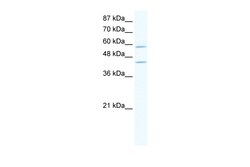 Aviva Systems Biology Corp DCP1A Antibody - N-terminal region (ARP34582_T100)