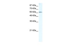 Aviva Systems Biology Corp METTL3 Antibody - middle region (ARP34590_T100)