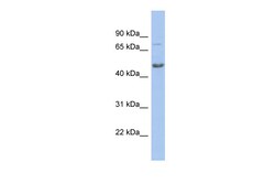 Aviva Systems Biology Corp CBX8 Antibody - N-terminal region (ARP34599_P050)