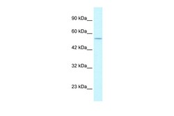 Aviva Systems Biology Corp EGLN1 Antibody - C-terminal region (ARP34608_T100)