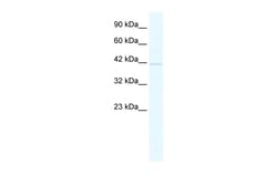 Aviva Systems Biology Corp BTBD14B Antibody - middle region (ARP34614_T100)