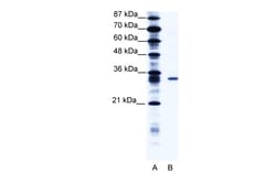 Aviva Systems Biology Corp KCNIP4 Antibody - N-terminal region (ARP34622_T100)