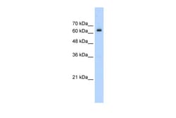 Aviva Systems Biology Corp BTBD14A Antibody - N-terminal region (ARP34627_T100)