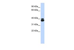 Aviva Systems Biology Corp OTP Antibody - N-terminal region (ARP34633_P050)