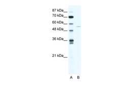 Aviva Systems Biology Corp ZNF289 Antibody - N-terminal region (ARP34642_T100)