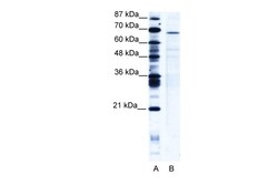 Aviva Systems Biology Corp PSIP1 Antibody - middle region (ARP34644_T100)