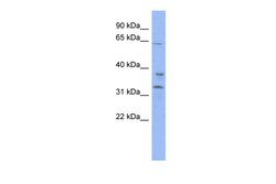 Aviva Systems Biology Corp KBTBD5 Antibody - middle region (ARP34663_P050)