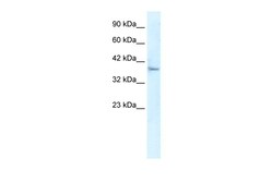 Aviva Systems Biology Corp KLHL14 Antibody - N-terminal region (ARP34677_T100)