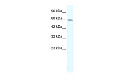 Aviva Systems Biology Corp TRIM3 Antibody - N-terminal region (ARP34698_T100)