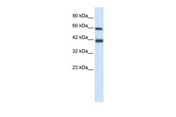 Aviva Systems Biology Corp TRIM31 Antibody - N-terminal region (ARP34717_P050)