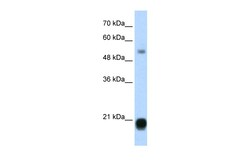 Aviva Systems Biology Corp CBX3 Antibody - middle region (ARP34721_T100)