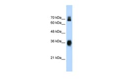 Aviva Systems Biology Corp KEAP1 Antibody - C-terminal region (ARP34728_T100)