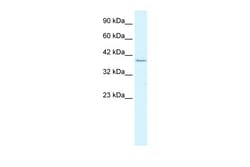 Aviva Systems Biology Corp RIMS3 Antibody - C-terminal region (ARP34736_T100)