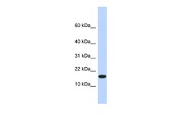 Aviva Systems Biology Corp EGLN2 Antibody - N-terminal region (ARP34747_P050)