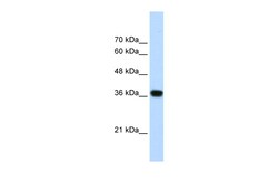 Aviva Systems Biology Corp PSIP1 Antibody - N-terminal region (ARP34753_T100)
