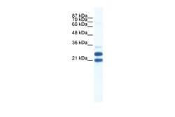Aviva Systems Biology Corp TRIM34 Antibody - N-terminal region (ARP34757_P050)