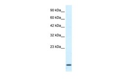 Aviva Systems Biology Corp HOXA1 Antibody - middle region (ARP34773_T100)