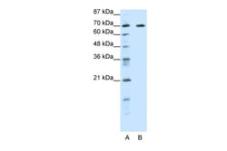 Aviva Systems Biology Corp FOXK2 Antibody - middle region (ARP34775_P050)