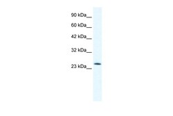 Aviva Systems Biology Corp TCF7 Antibody - N-terminal region (ARP34781_P050)