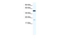Aviva Systems Biology Corp TCF7 Antibody - middle region (ARP34782_P050)