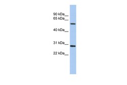 Aviva Systems Biology Corp TRIM38 Antibody - N-terminal region (ARP34799_P050)