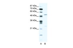 Aviva Systems Biology Corp BRD9 Antibody - N-terminal region (ARP34803_T100)