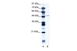 Aviva Systems Biology Corp ZNF627 Antibody - N-terminal region (ARP34806_T100)