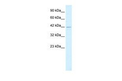 Aviva Systems Biology Corp HSF2BP Antibody - N-terminal region (ARP34837_T100)