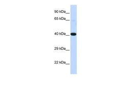 Aviva Systems Biology Corp HSF2BP Antibody - N-terminal region (ARP34838_P050)