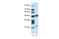 Aviva Systems Biology Corp PHF11 Antibody - middle region (ARP34848_P050)