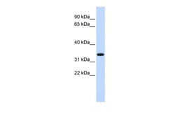 Aviva Systems Biology Corp TRIM14 Antibody - middle region (ARP34860_P050)