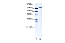 Aviva Systems Biology Corp TRIM9 Antibody - C-terminal region (ARP34861_T100)
