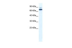 Aviva Systems Biology Corp ZNF57 Antibody - N-terminal region (ARP34891_P050)
