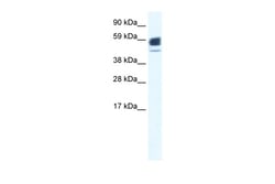 Aviva Systems Biology Corp CHRNA1 Antibody - N-terminal region (ARP34910_P050)