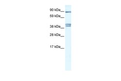 Aviva Systems Biology Corp CLCNKB Antibody - C-terminal region (ARP34917_P050)