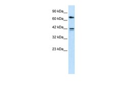 Aviva Systems Biology Corp CACNB1 Antibody - N-terminal region (ARP34953_P050)