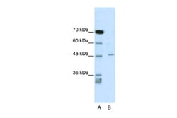 Aviva Systems Biology Corp CACNB4 Antibody - C-terminal region (ARP34959_P050)