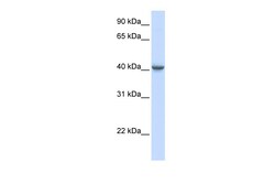 Aviva Systems Biology Corp GABRA1 Antibody - middle region (ARP34977_P050)