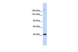 Aviva Systems Biology Corp GRIN2A Antibody - middle region (ARP35012_P050)