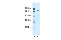 Aviva Systems Biology Corp ACCN1 Antibody - C-terminal region (ARP35033_P050)
