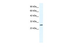 Aviva Systems Biology Corp CLIC1 Antibody - N-terminal region (ARP35045_T100)
