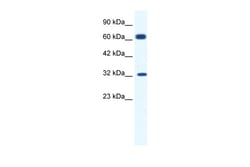 Aviva Systems Biology Corp KCNN1 Antibody - C-terminal region (ARP35095_T100)