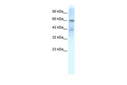 Aviva Systems Biology Corp KCND3 Antibody - middle region (ARP35165_T100)