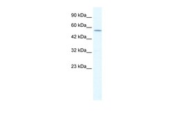 Aviva Systems Biology Corp KCNA10 Antibody - middle region (ARP35178_T100)