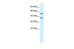 Aviva Systems Biology Corp HTR3B Antibody - N-terminal region (ARP35186_P050)