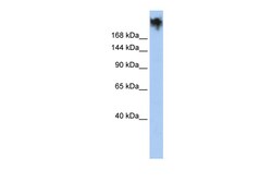 Aviva Systems Biology Corp PKDREJ Antibody - middle region (ARP35187_P050)
